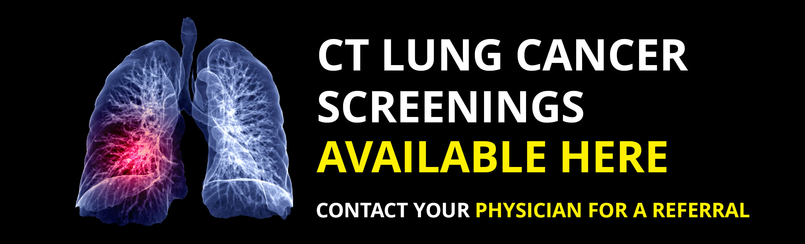 CT LUNG CANCER SCREENINGS Available here

Contact your physician for a referral
