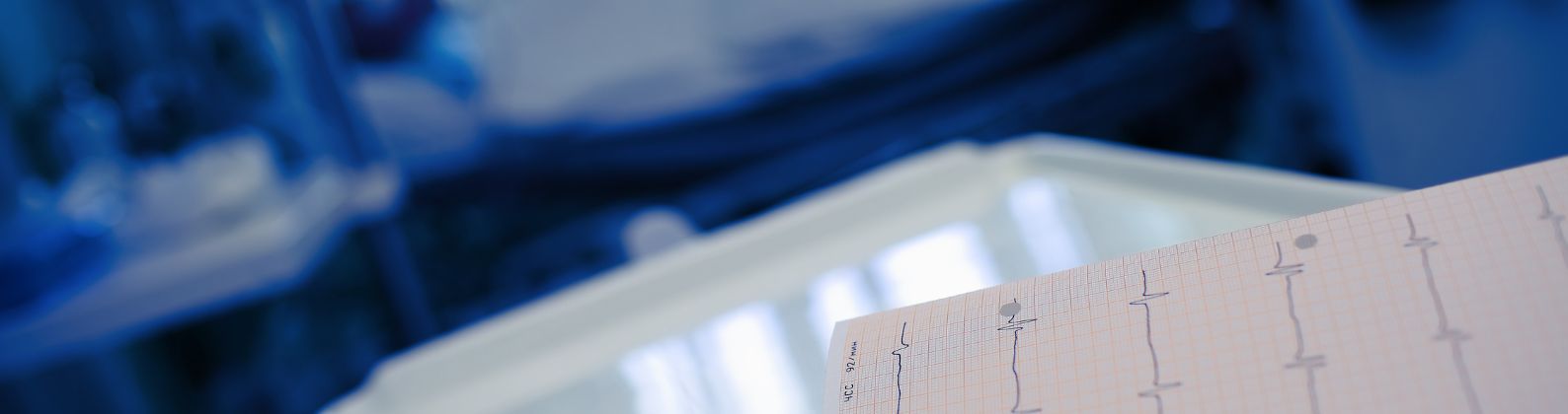 heart beat monitor print out