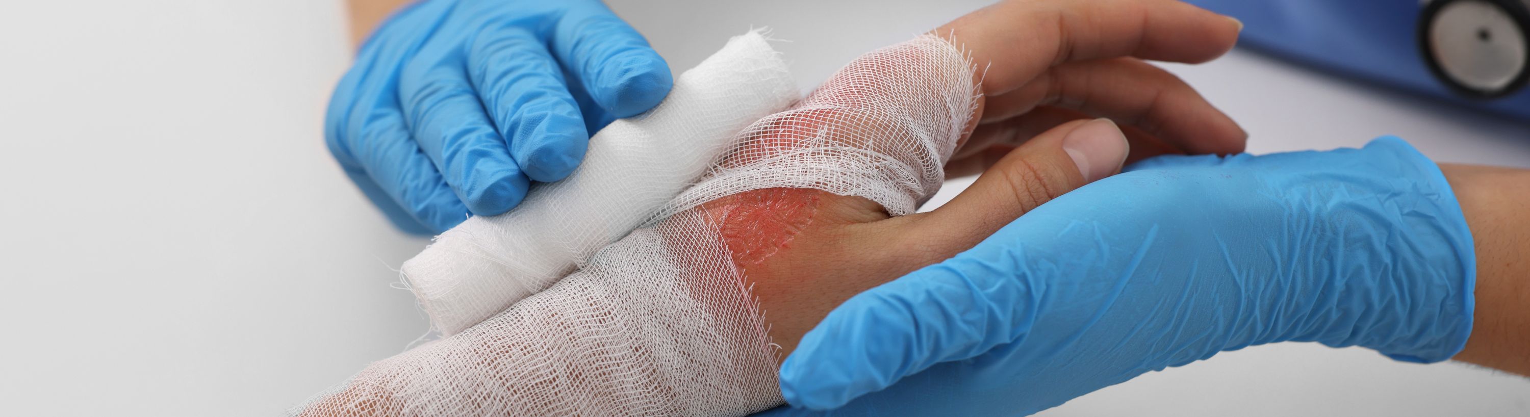 injured hand being wrapped in gauze