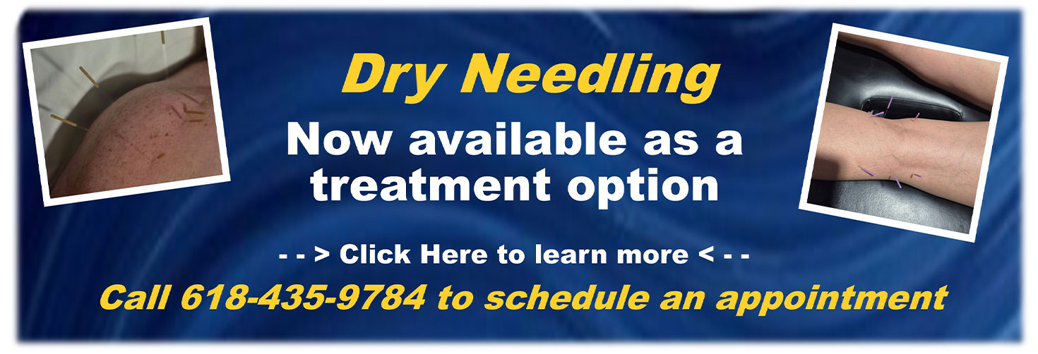 Dry Needling