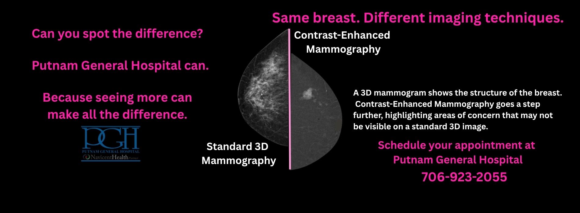New Mammography Technology at PGH